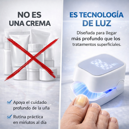 Nail Pro® Dispositivo láser para tratamiento de hongos en las uñas