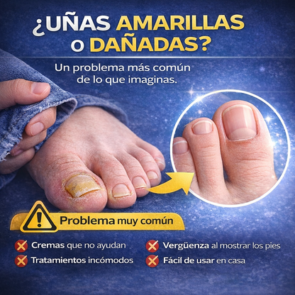 NailCare KIT - Sistema Láser para el Cuidado de Uñas + Parches Nocturnos GRATIS