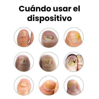 OrthoVital® Solución triple acción —combate, cura y refuerza— para tus uñas